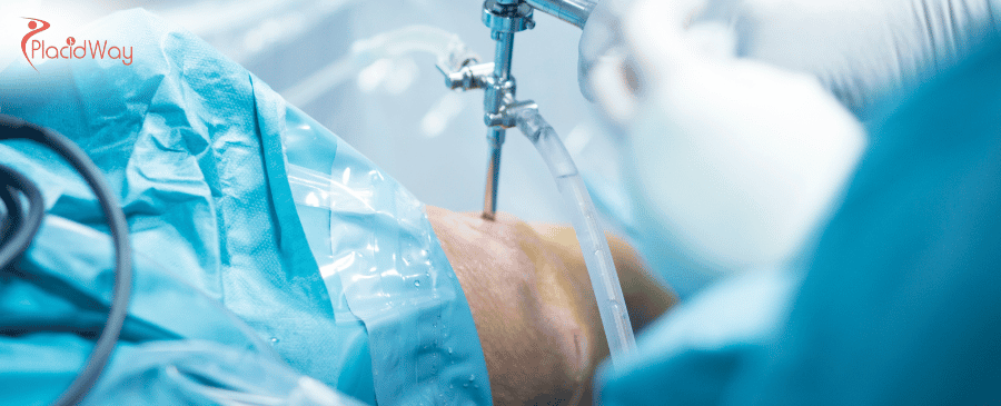 Knee Replacement in Mexico 