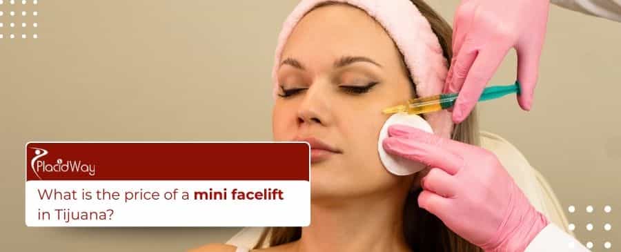 Mini lifting facial en Tijuana