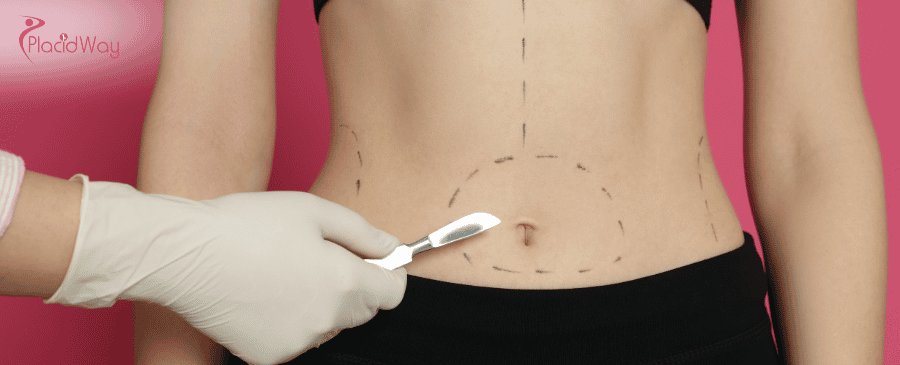 Bariatric Surgery in Thailand