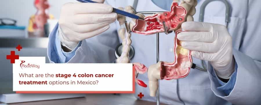 Tratamiento del cáncer de colon en etapa 4
