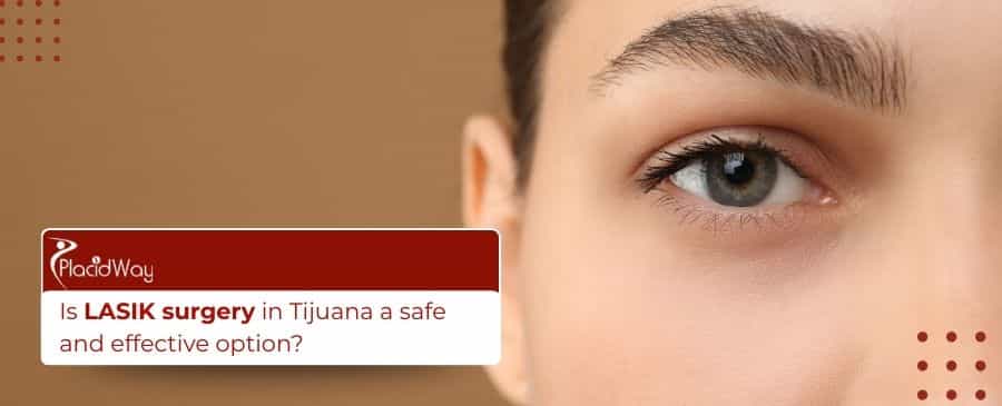 Cirugía LASIK