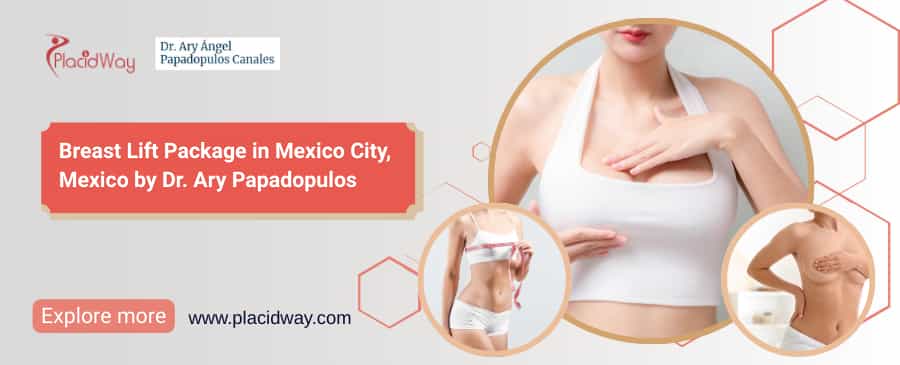 Levantamiento de senos en México por el Dr. Ary | Paquete de mastopexia