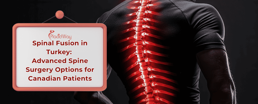 Spinal Fusion Surgery in Turkey