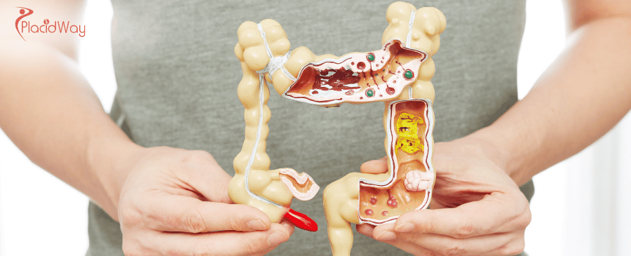 Schlauchmagenoperation in Mexiko