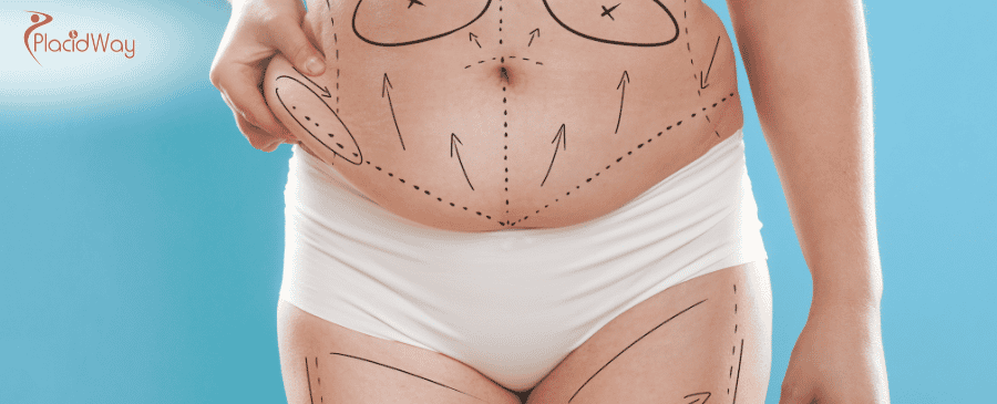 Tummy Tuck in Turkey