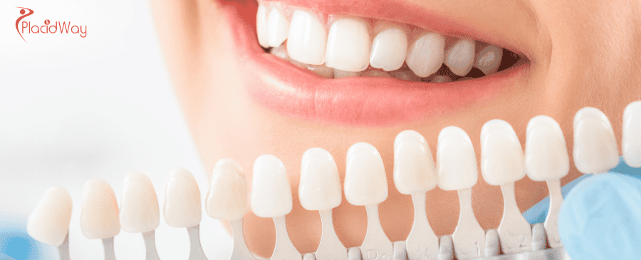 Dental Crowns in Mexico