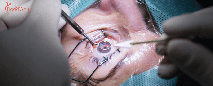 Affordable Cornea Transplant in Thailand