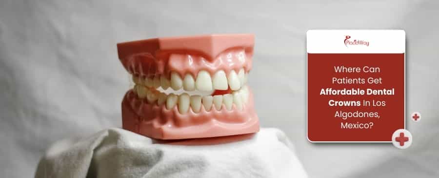 Coronas dentales asequibles