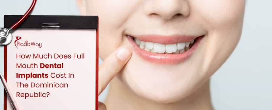 Full Mouth Dental Implants