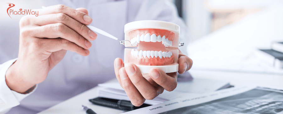 Full Mouth Dentures in Colombia