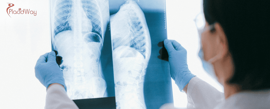 Posterior Fusion Spine Surgery in Turkey