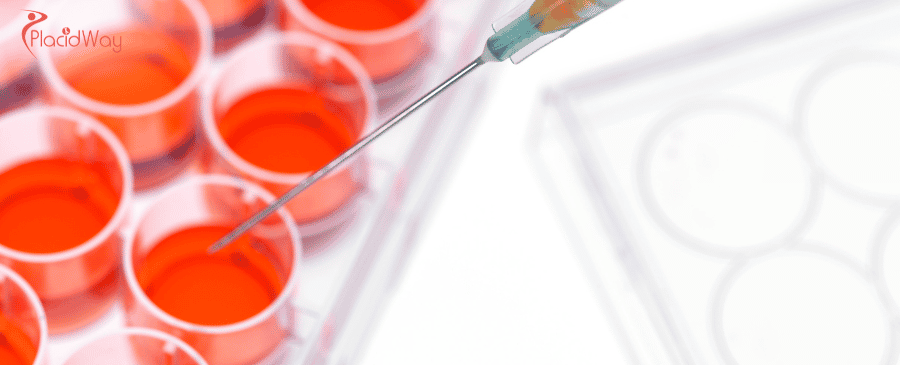 Stem Cell Cartilage Regeneration in Colombia