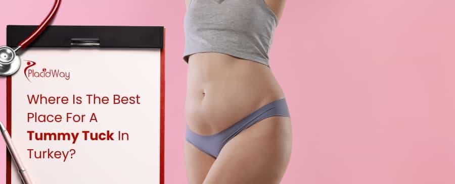 Tummy Tuck