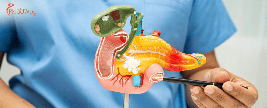 Pancreatic Cancer Immunotherapy in Mexico