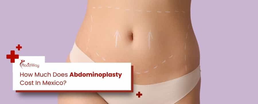Abdominoplastia en México