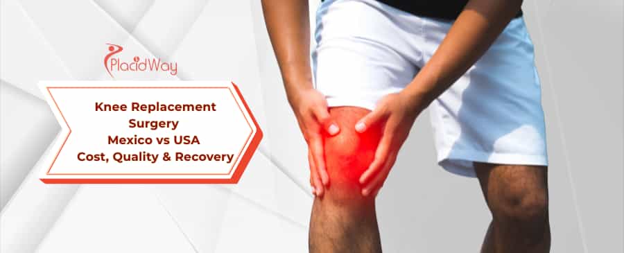 knee replacement surgery in Mexico vs the USA