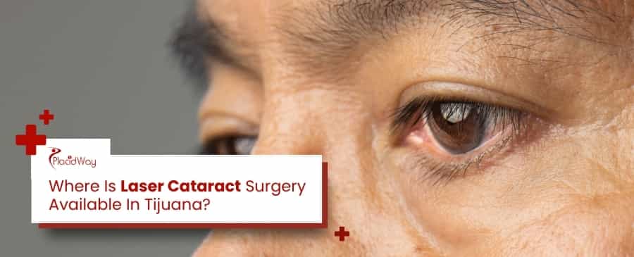 Laser Cataract Surgery