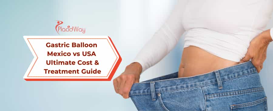Gastric Balloon Mexico vs USA