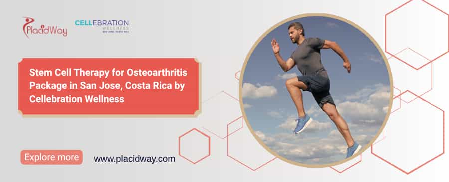 Osteoarthritis Stem Cell Injections San Jose | Cellebration