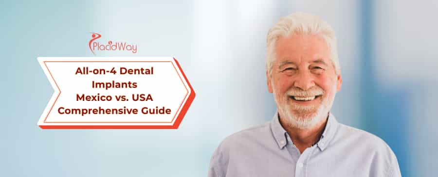 All-on-4 Dental Implants in Mexico vs. USA