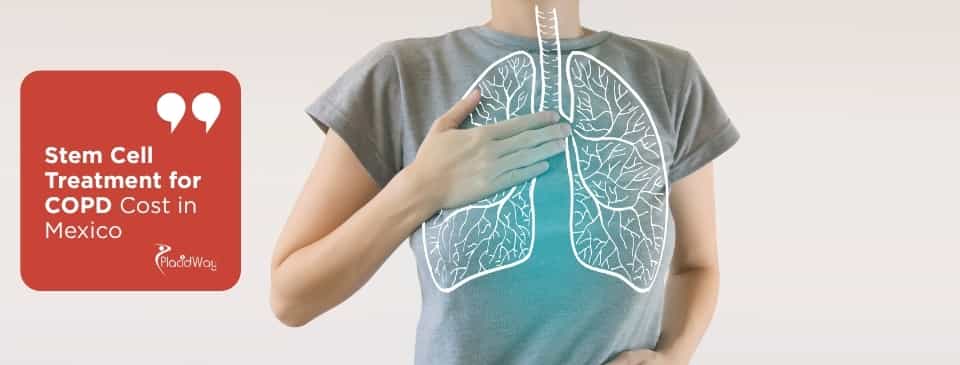 Stem Cell Treatment for COPD