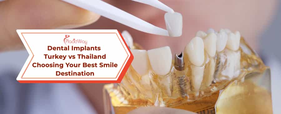 Dental Implants Turkey vs Thailand