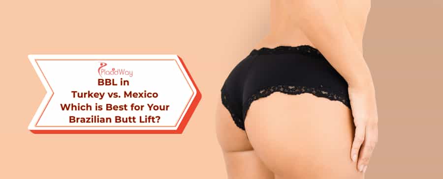 BBL in Turkey vs. Mexico