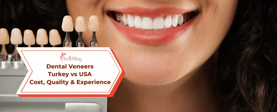 Dental Veneers: Turkey vs USA