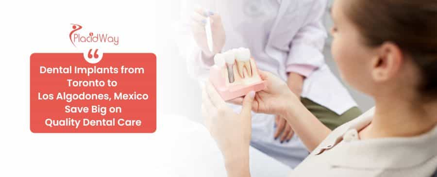 Dental implants in Mexico