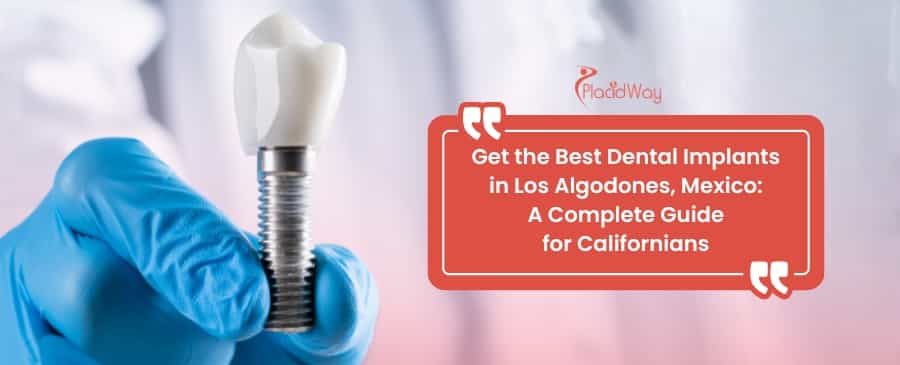 Get the Best Dental Implants in Los Algodones, Mexico