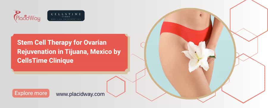 Células Madre Tijuana para Rejuvenecimiento Ovárico – $8,000