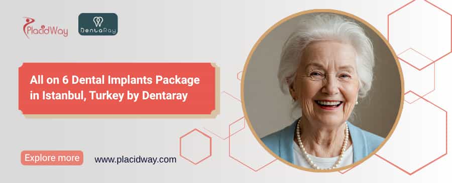 Implantes dentales All on 6 en Turquía | Dentaray $15,545