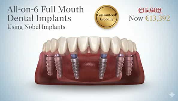 Implantes dentales de arco completo en Turquía en Dentaray