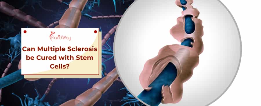 Stem Cells for MS