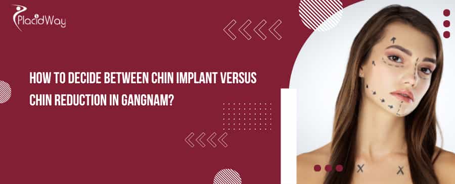  Chin implant Versus Chin Reduction in Gangnam