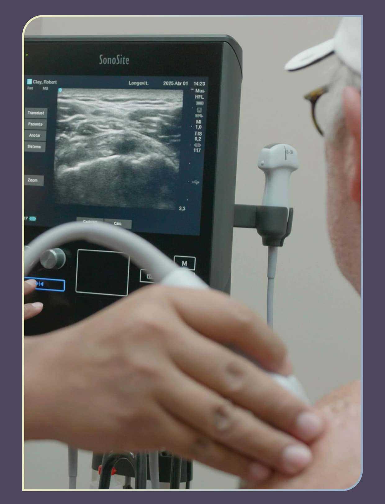 Mesenchymal Stem Cell Therapy Mexico