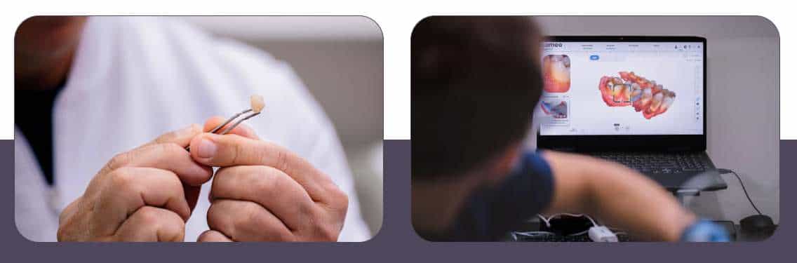 Regenerative Dentistry San Jose del Cabo