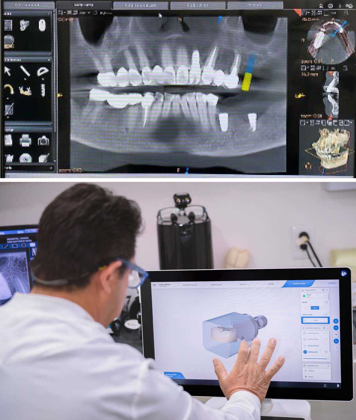 Dental Therapy Mexico