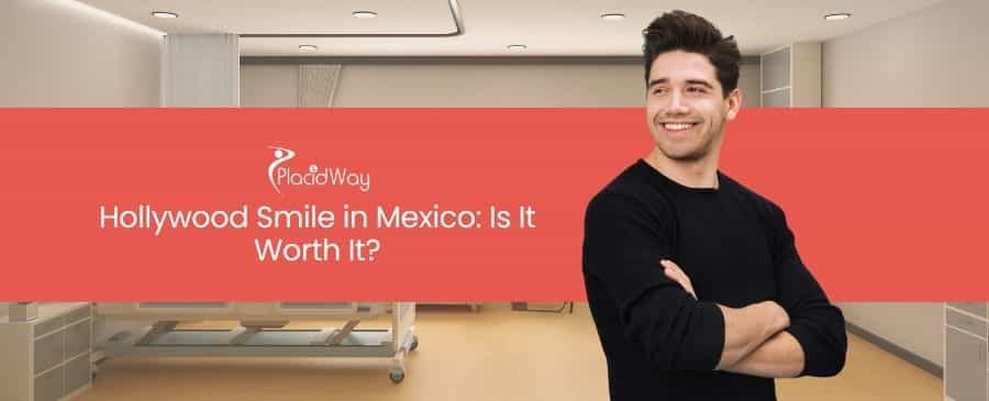 Sonrisa de Hollywood en México