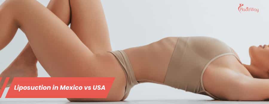 Liposuction in Mexico vs USA