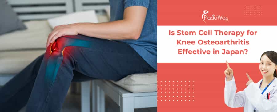 Stem Cell Therapy for Knee Osteoarthritis in Japan