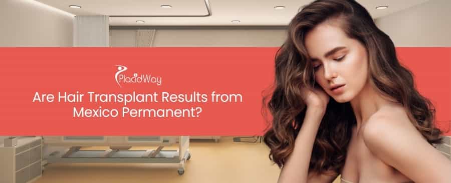 Hair Transplant Results from Mexico