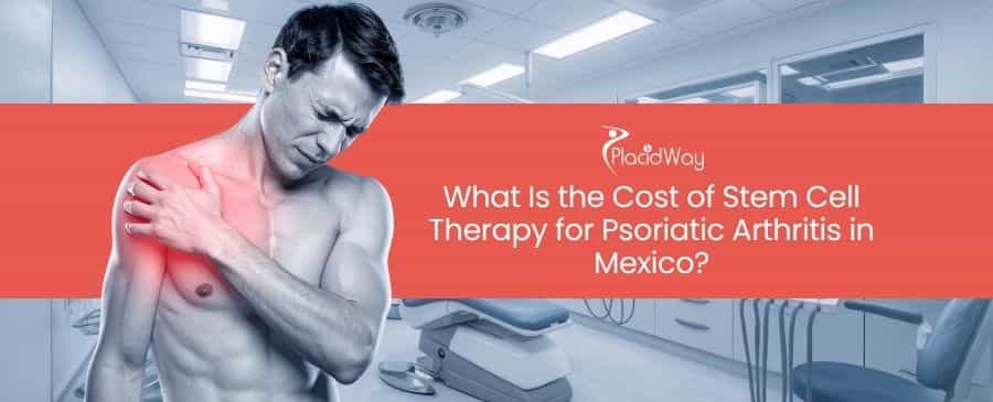Stem Cell Therapy for Psoriatic Arthritis in Mexico