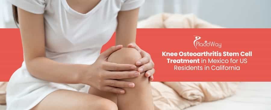 Tratamiento con células madre para la osteoartritis de rodilla en México