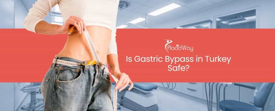 Gastric Bypass in Turkey