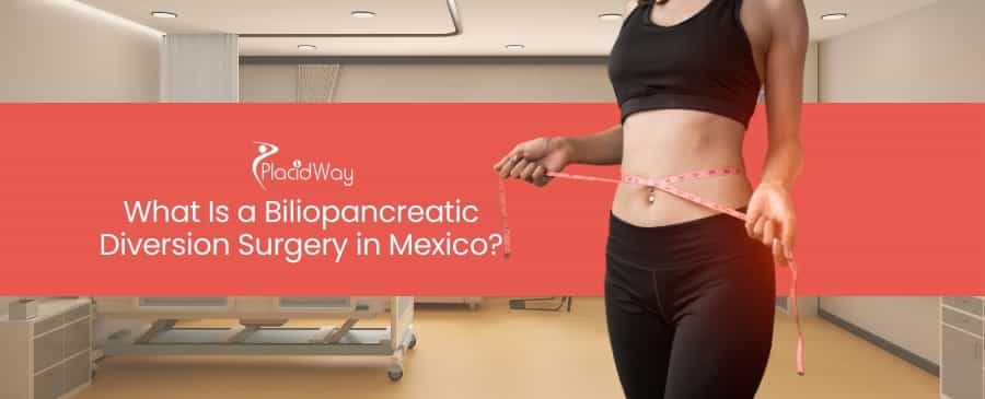 Biliopancreatic Diversion Surgery in Mexico