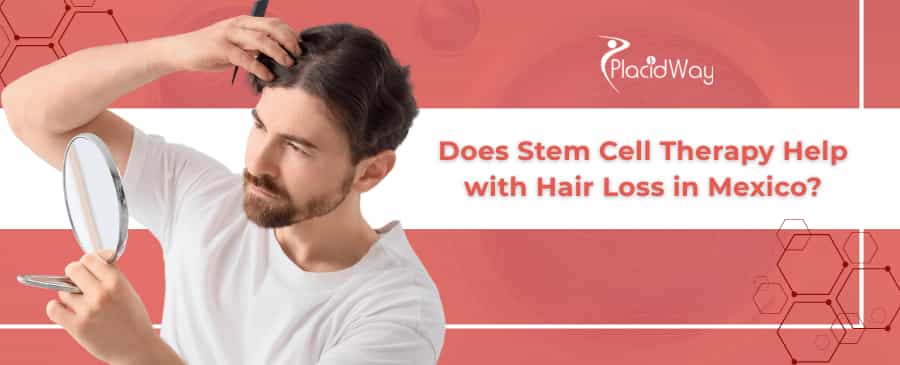 Stem Cell Therapy for Hair Loss in Mexico