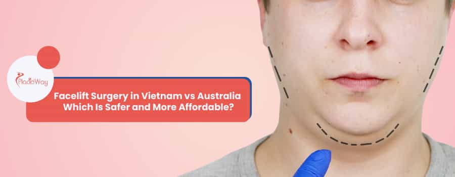 Facelift Surgery in Vietnam vs Australia