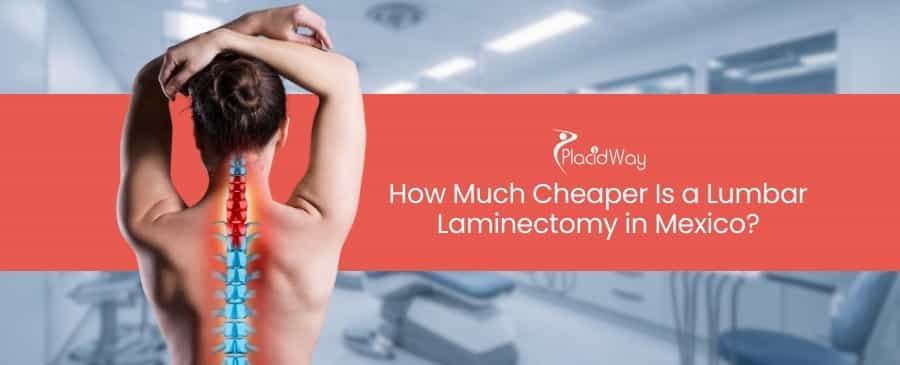 Lumbar Laminectomy in Mexico