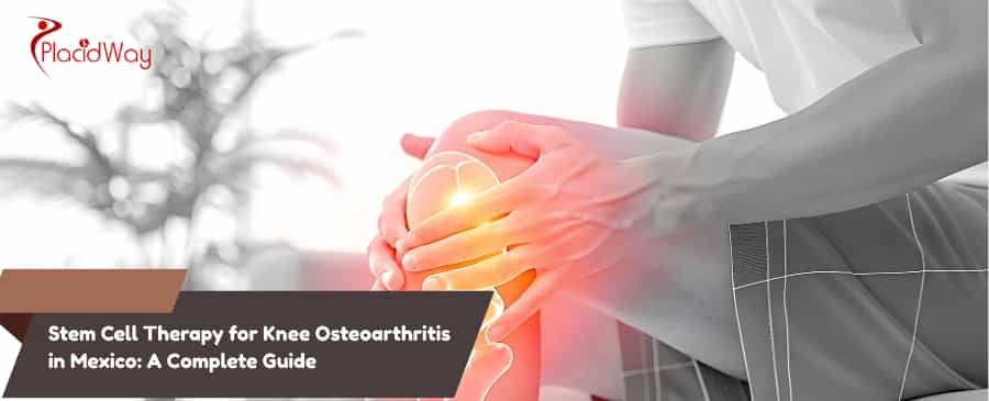 Stem Cell Therapy for Knee Osteoarthritis in Mexico